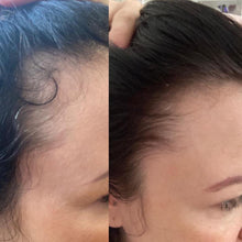 Load image into Gallery viewer, Hair Gain Gummies (60)