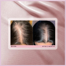 Load image into Gallery viewer, Hair Gain Capsules (60)